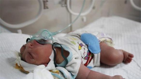 iraqi birth defects